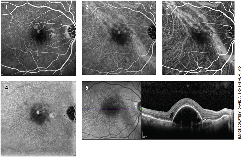 Ophthalmology Management | PentaVision