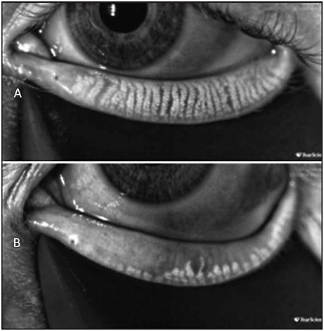 Ophthalmology Management | PentaVision