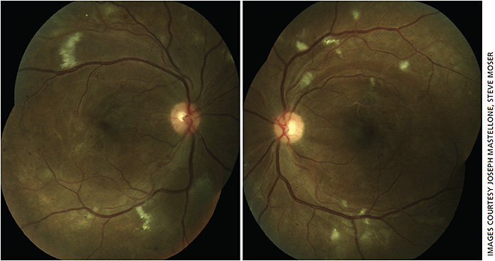 Ophthalmology Management | PentaVision