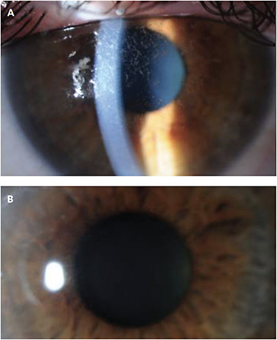 Ophthalmology Management | PentaVision