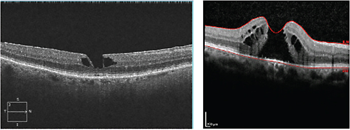 Ophthalmology Management PentaVision