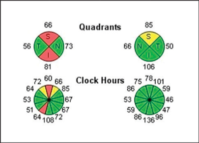 Ophthalmology Management | PentaVision
