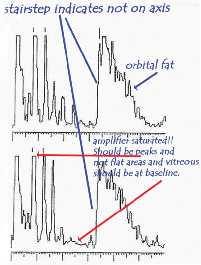 Ophthalmology Management | PentaVision