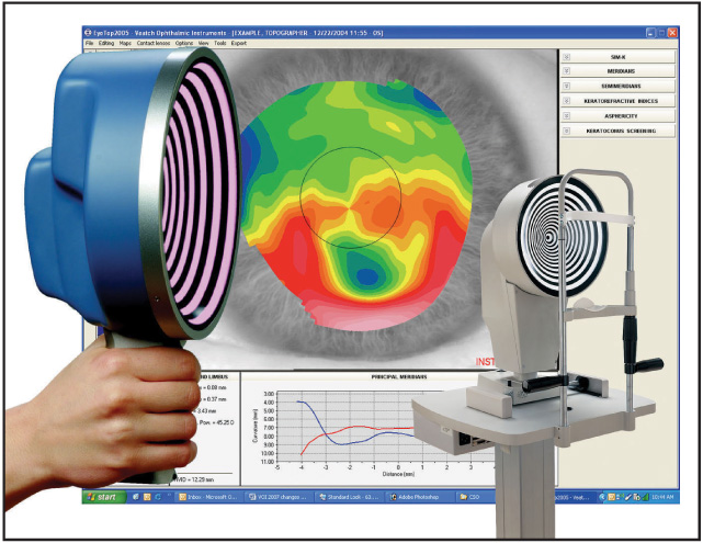 Ophthalmology Management | PentaVision