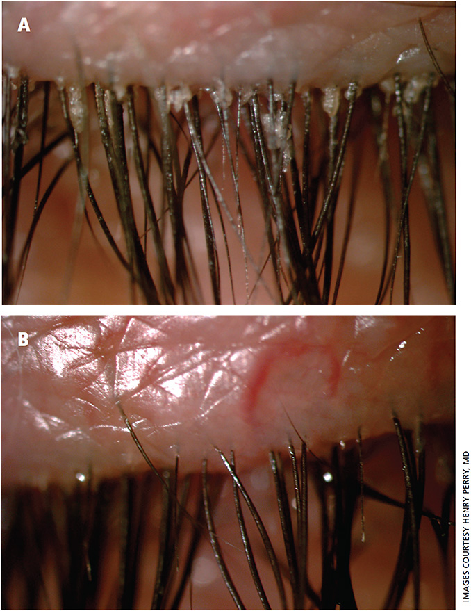 Ophthalmology Management | PentaVision