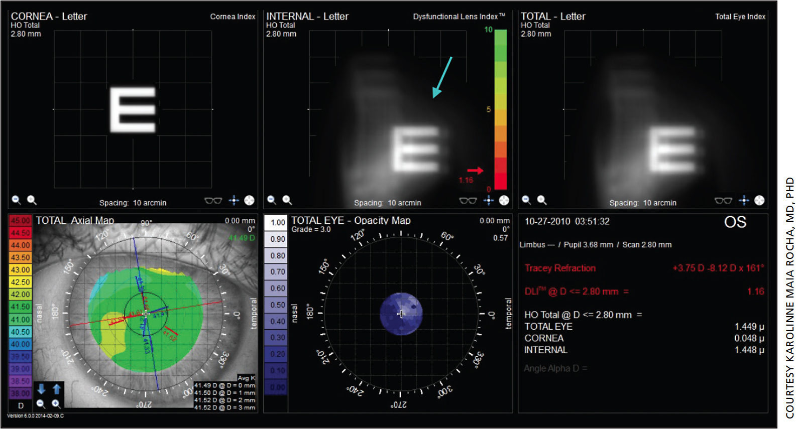 Ophthalmology Management | PentaVision