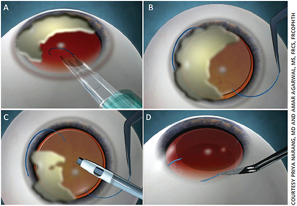 Ophthalmology Management | PentaVision